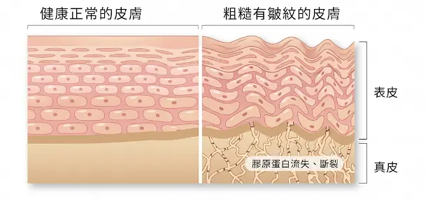 膠原蛋白流失對比圖